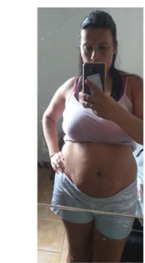 Antes